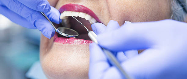 Best Emergency Dental Surgery in Bellview, FL